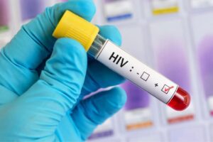 HIV FOTO